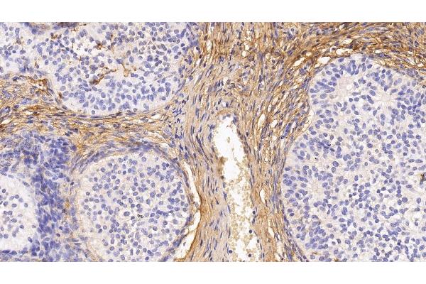 PIIINP antibody