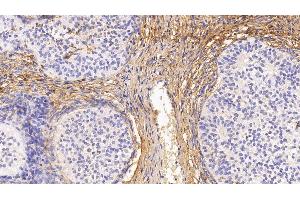 Detection of PIIINP in Human Ovary Tissue using Monoclonal Antibody to Procollagen III N-Terminal Propeptide (PIIINP) (PIIINP antibody)