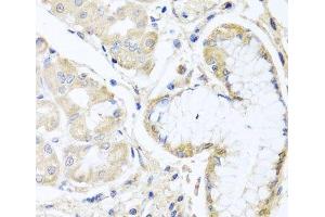 Immunohistochemistry of paraffin-embedded Human stomach using INPP5K Polyclonal Antibody at dilution of 1:100 (40x lens). (INPP5K antibody)