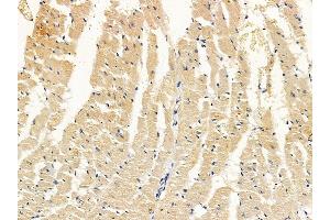 ABIN7094194 and ABIN7098240 at 1/100 staining rat heart tissue by IHC-P. (EHD2 antibody  (Internal Region))