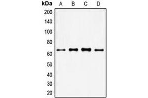 Western blot analysis of FOXO4 expression in HeLa (A), MM142 (B), HuT78 (C), NIH3T3 (D) whole cell lysates. (FOXO4 antibody  (Center))