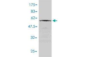 Western Blot detection against Immunogen (52. (RAD51 antibody  (AA 1-242))