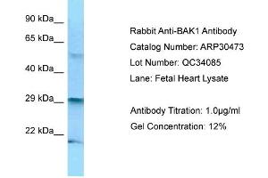 WB Suggested Anti-BAK1 Antibody   Titration: 1. (BAK1 antibody  (N-Term))