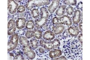 Expression of AQP1 in rat kidney - Immunohistochemical staining of paraffin-embedded rat kidney sections using Anti-Aquaporin 1 Antibody (ABIN7042932, ABIN7045194 and ABIN7045195), (1:100). (Aquaporin 1 antibody  (Intracellular))