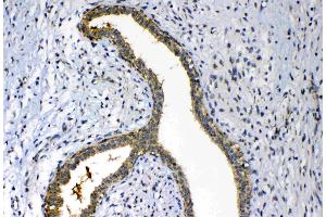 IHC analysis of FH using anti-FH antibody . (FH antibody)