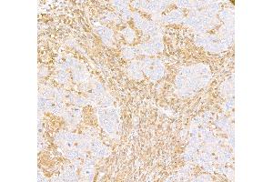 Immunohistochemistry (IHC) image for anti-ARHGDIB/D4-GDI/RhoGDI2 (AA 50-100) antibody (ABIN7453574) (ARHGDIB/D4-GDI/RhoGDI2 (AA 50-100) antibody)