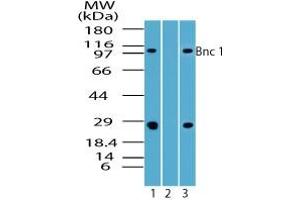 Image no. 1 for anti-Basonuclin 1 (BNC1) (AA 330-380) antibody (ABIN960100) (Basonuclin 1 antibody  (AA 330-380))