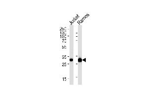 CASP3 Antibody (ABIN1882213 and ABIN2838477) western blot analysis in Jurkat,Ramos cell line lysates (35 μg/lane).