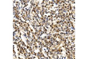 IHC analysis of TIMM29 using anti-TIMM29 antibody (ABIN7601495). (TIMM29 antibody  (AA 37-260))