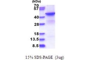 SDS-PAGE (SDS) image for Betaine--Homocysteine S-Methyltransferase 2 (BHMT2) (AA 1-363) protein (His tag) (ABIN7280670) (BHMT2 Protein (AA 1-363) (His tag))