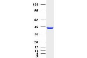 Hydroxymethylbilane Synthase (HMBS) (Transcript Variant 1) protein (Myc-DYKDDDDK Tag)