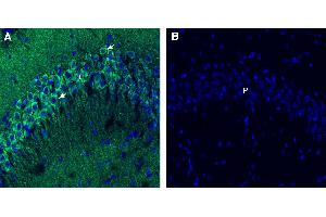 Free-floating frozen brain sections from a paraformaldehyde-perfused mouse were incubated with Anti-Endophilin-A1 antibody (ABIN7884928: 1:300), followed by goat anti-rabbit secondary antibody conjugated to Alexa Fluor® 488 (green). (SH3G2 antibody  (Intracellular))