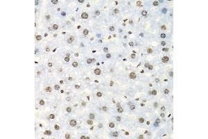 Immunohistochemistry of paraffin-embedded mouse liver using IGF2BP2 antibody. (IGF2BP2 antibody  (C-Term))