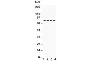 Western blot testing of Tau antibody and 1.