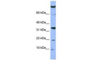 Image no. 1 for anti-Family with Sequence Similarity 178, Member B (FAM178B) (AA 607-656) antibody (ABIN6741667) (FAM178B antibody  (AA 607-656))