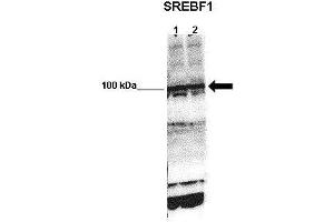 WB Suggested Anti-SREBF1 Antibody    Positive Control:  Lane 1: 50ug mouse glomerular endothelial lysate Lane 2: 50ug mouse glomerular endothelial lysate   Primary Antibody Dilution :   1:1000   Secondary Antibody :  Anti-rabbit-HRP   Secondry Antibody Dilution :   1:5000   Submitted by:  Xiaoxin Wang, UC Denver (SREBF1 antibody  (N-Term))