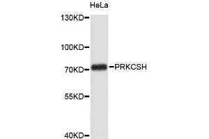 Western blot analysis of extracts of HeLa cells, using PRKCSH antibody (ABIN5972209). (PRKCSH antibody)