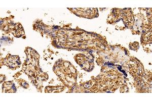 Detection of EGFR in Human Placenta Tissue using Monoclonal Antibody to Epidermal Growth Factor Receptor (EGFR) (EGFR antibody  (AA 888-1210))