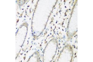 Immunohistochemistry of paraffin-embedded human stomach using EIF2B2 antibody at dilution of 1:200 (40x lens).