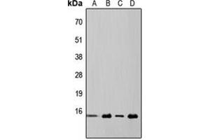 Western blot analysis of 4EBP1 expression in HeLa (A), MCF7 (B), mouse kidney (C), rat liver (D) whole cell lysates. (eIF4EBP1 antibody  (Center))
