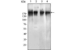 Western blot analysis using EGFR mutant mouse mAb against SPC-A-1 (1), A549 (2), HepG2 (3) and MCF-7 (4) cell lysate. (EGFR antibody  (Mutant))