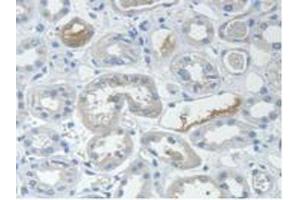 IHC-P analysis of Human Kidney Tissue, with DAB staining. (STAM2 antibody  (AA 1-377))