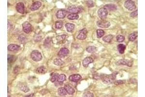 Immunohistochemistry (IHC) image for anti-Inhibin, alpha (INHA) (truncated) antibody (ABIN2464073)