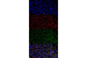 Immunocytochemistry/Immunofluorescence analysis using Mouse Anti-Hexanoyl-Lysine adduct Monoclonal Antibody, Clone 5E8 . (Hexanoyl-Lysine Adduct (HEL) antibody (Atto 594))