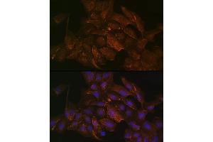 Immunofluorescence analysis of U2OS cells using KRAS+HRAS+NRAS Rabbit mAb (ABIN7267531) at dilution of 1:100 (40x lens). (GTPase NRas antibody)