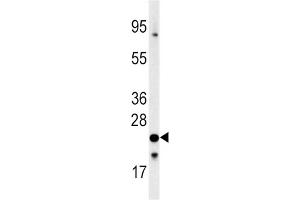 Western Blotting (WB) image for anti-Frataxin (FXN) antibody (ABIN3002642) (Frataxin antibody)