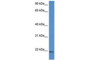 Image no. 1 for anti-Ubiquitin-Conjugating Enzyme E2G 1 (Ube2g1) (AA 44-93) antibody (ABIN6747214) (UBE2G1 antibody  (AA 44-93))