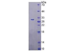 SDS-PAGE analysis of Human TMEM173 Protein.
