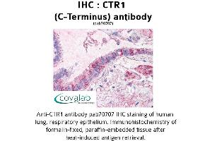 SLC31A1 Antikörper  (C-Term)