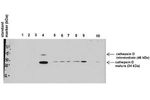 Western Blotting (WB) image for anti-Cathepsin D (CTSD) (C-Term) antibody (ABIN2776841)