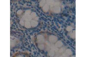 IHC-P analysis of Human Tissue, with DAB staining. (F4/80 antibody  (AA 1-201))