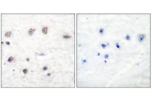 Immunohistochemistry (IHC) image for anti-Adducin 1 (Alpha) (ADD1) (pSer726) antibody (ABIN1847203) (alpha Adducin antibody  (pSer726))