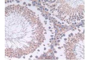 IHC-P analysis of Rat Testis Tissue, with DAB staining. (IL12A antibody  (AA 23-215))