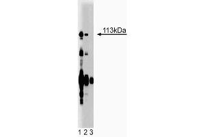 Western blot analysis of Itch on rat liver lysate. (ITCH antibody  (AA 114-220))