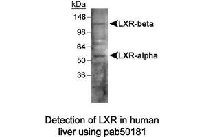 Image no. 1 for anti-Liver X Receptor (LXR) antibody (ABIN363490) (Liver X Receptor antibody)