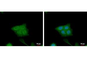 ICC/IF Image CRABP2 antibody [N1C3] detects CRABP2 protein at cytoplasm and nucleus by immunofluorescent analysis.