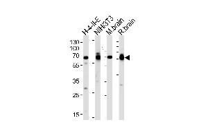 Western blot analysis of lysates from H-4-II-E, mouse NIH/3T3 cell line, mouse brain and rat brain tissues (from left to right), using STIP1 Antibody (C-term) (ABIN389319 and ABIN2839437).
