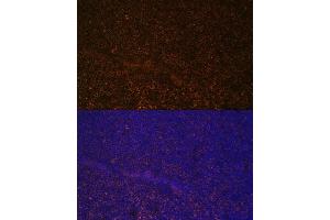 Immunofluorescence (IF) image for anti-Complement Component (3d/Epstein Barr Virus) Receptor 2 (CR2) (AA 300-590) antibody (ABIN6138992)