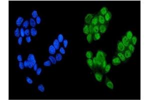 IF analysis of KDM5B using anti-KDM5B antibody (ABIN4886648). (KDM5B antibody  (Middle Region))