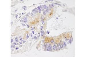 Immunohistochemistry (IHC) image for anti-Echinoderm Microtubule Associated Protein Like 4 (EML4) (AA 150-200) antibody (ABIN7448551) (EML4 antibody  (AA 150-200))