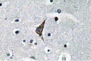 Immunohistochemistry (IHC) analyzes of TLR4 antibody in paraffin-embedded human brain tissue. (TLR4 antibody)