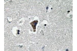 Immunohistochemistry analyzes of MyD88 antibody in paraffin-embedded human brain tissue. (MYD88 antibody)