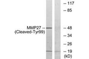 Western blot analysis of extracts from COS7 cells, treated with etoposide 25uM 1h, using MMP27 (Cleaved-Tyr99) Antibody. (MMP27 antibody  (Cleaved-Tyr99))
