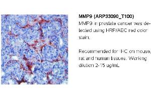 Image no. 2 for anti-Matrix Metallopeptidase 9 (Gelatinase B, 92kDa Gelatinase, 92kDa Type IV Collagenase) (MMP9) (N-Term) antibody (ABIN182741) (MMP 9 antibody  (N-Term))