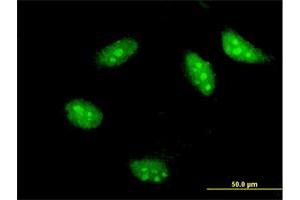 Immunofluorescence of monoclonal antibody to TWIST1 on HeLa cell. (TWIST1 antibody  (AA 100-202))