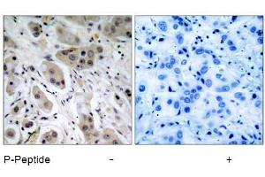 Image no. 1 for anti-V-Akt Murine Thymoma Viral Oncogene Homolog 1 (AKT1) (pSer473) antibody (ABIN196709) (AKT1 antibody  (pSer473))